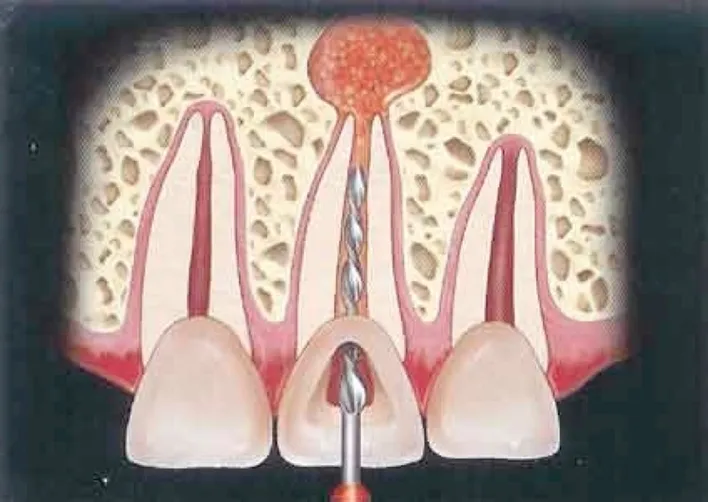 rotary_endodontics1.jpg