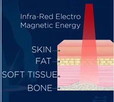 Lakewood Chiropractic Class IV Laser Therapy