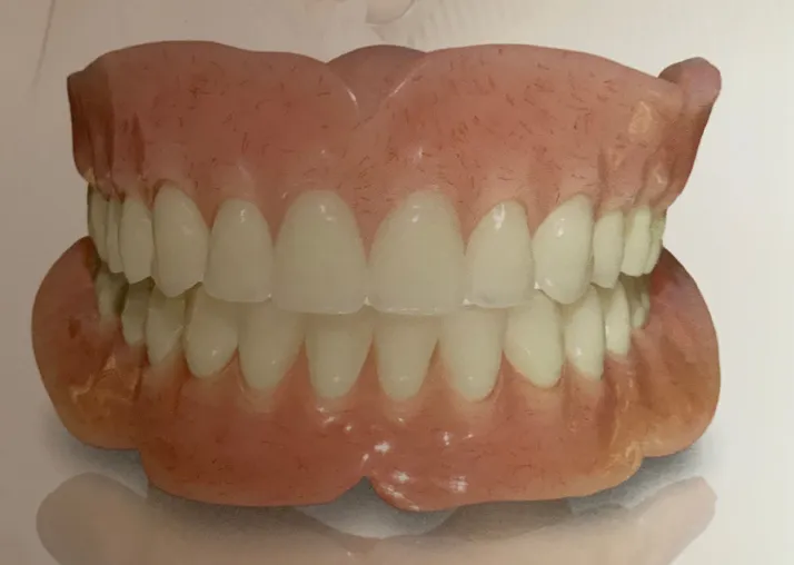 Dentures in Reston, VA