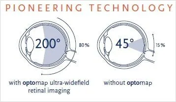 optomap-illustration-angles-of-retina.jpg