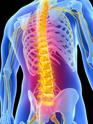 Spine Image that needs decompression in Sugar Land