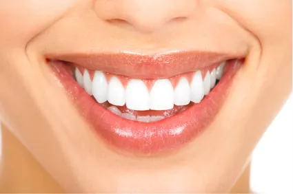 close up of woman's smiling mouth, perfect teeth bright white, cosmetic dentistry Little Falls, NJ smile makeover