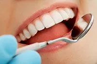 Close up photograph of beautiful smile after dental bonding in Cambridge, ON
