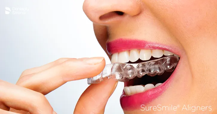 woman putting in SureSmile clear aligners Arlington, TX