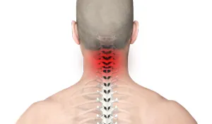 neck pain