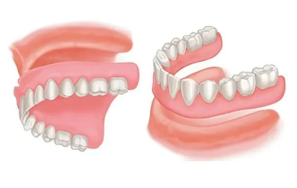 Complete_denture.jpg