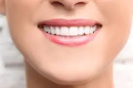 woman's smiling mouth with dental veneers Melrose, MA cosmetic dentistry
