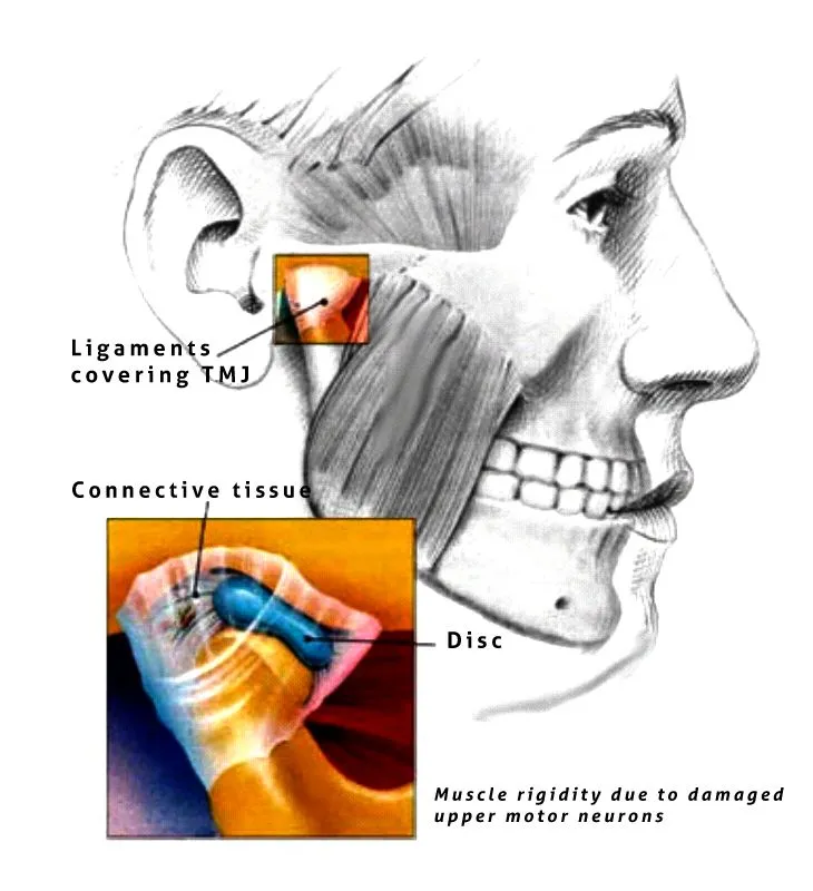 Drawing of skull, muscles and TMJ