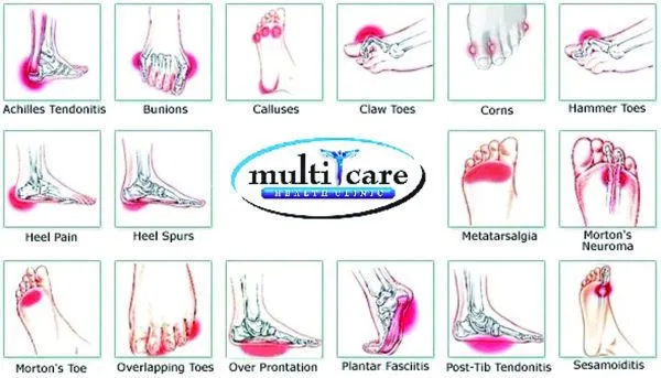 Foot Pain Conditions