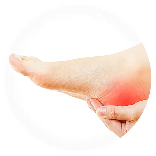 plantar heel pain plantar fasciitis