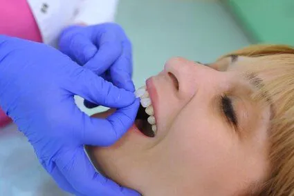 gloved dentist's hands placing veneer pieces on woman's front teeth, dental veneers Charlotte, NC cosmetic dentistry