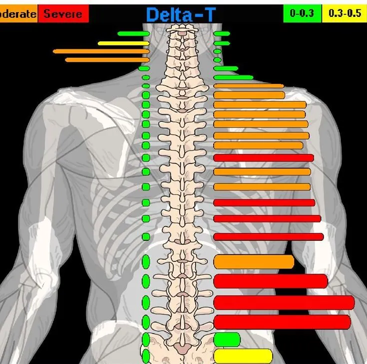 Full Spine Thermal Scans | Chiropractor In Plantation, FL | Nob Hill ...