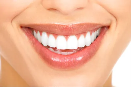 close up of woman's smiling mouth, beautiful white straight teeth, cosmetic dentistry Westminster, MD