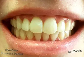 ORTHO,INVISALIGN