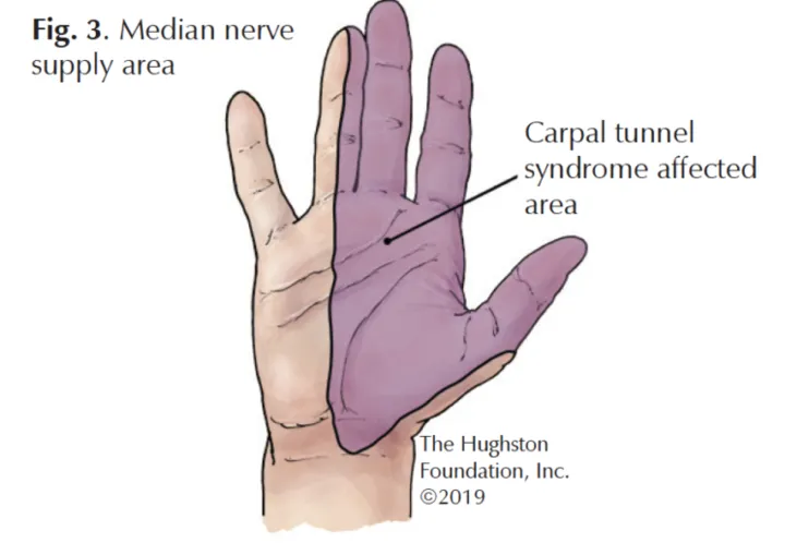 median nerve