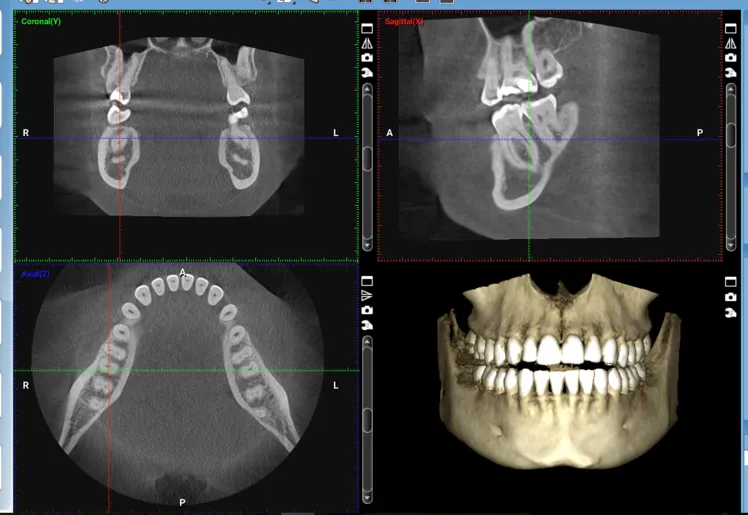 CBCT.png