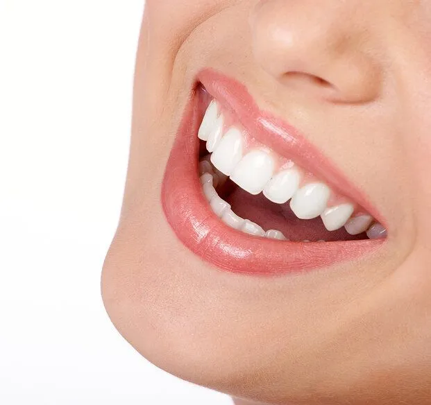 Veneers Kitchener ON