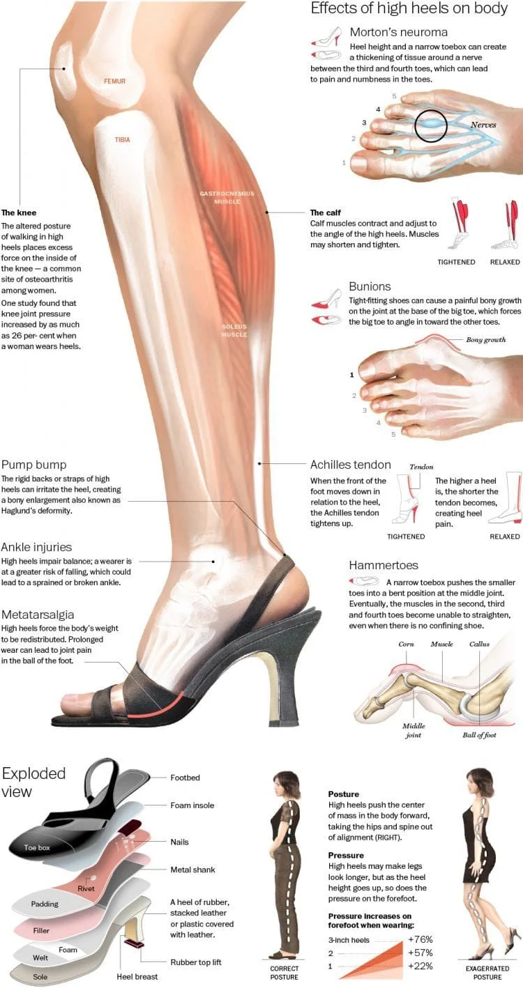 effects of high heels