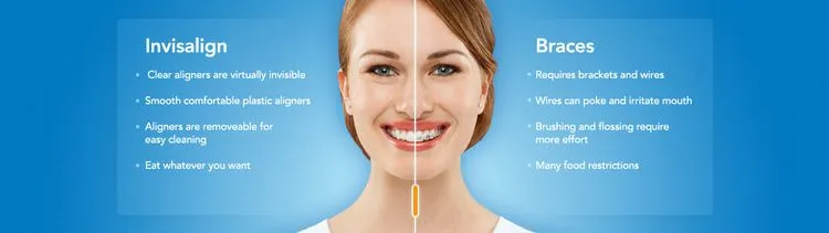 Invisalign | Dentist in Germantown, TN | WIlson Dental Care