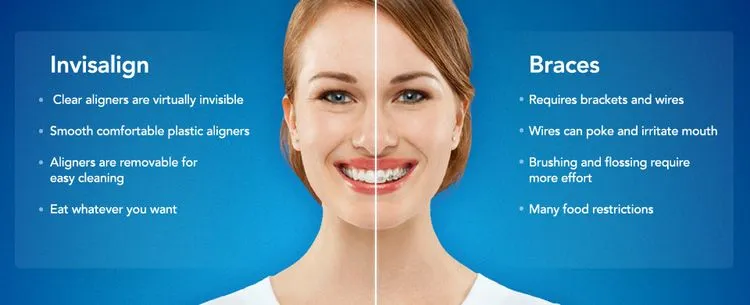 Invisalign NH Manchester Dentist