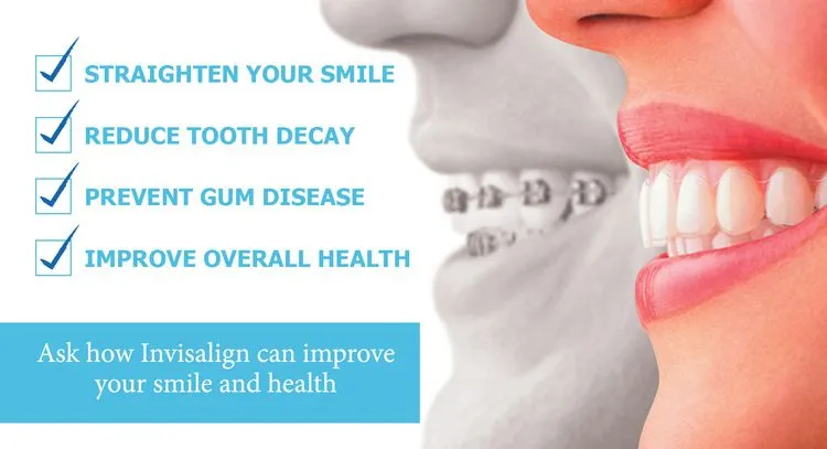 Invisalign | Dentist in Germantown, TN | WIlson Dental Care