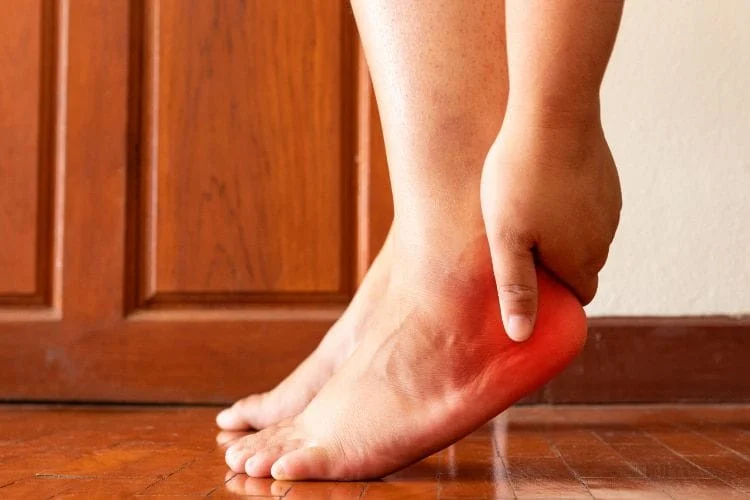 Female foot suffers from Plantar Fasciitis