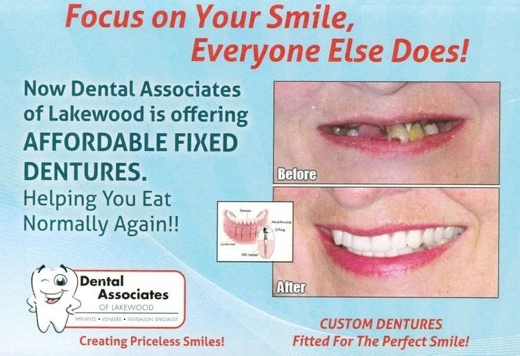 same day teeth and dentures with the best dentist in new jersey 