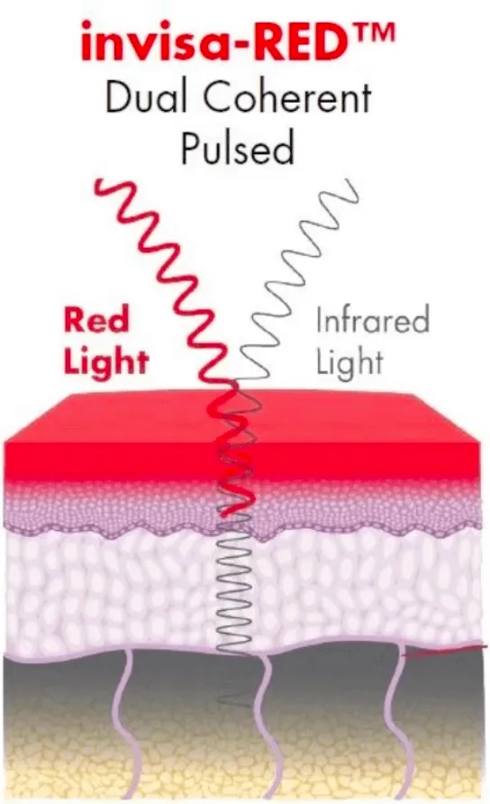 IR Dual Pulsed