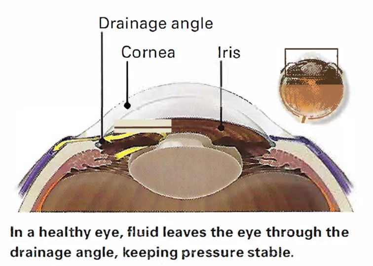 eye diagram