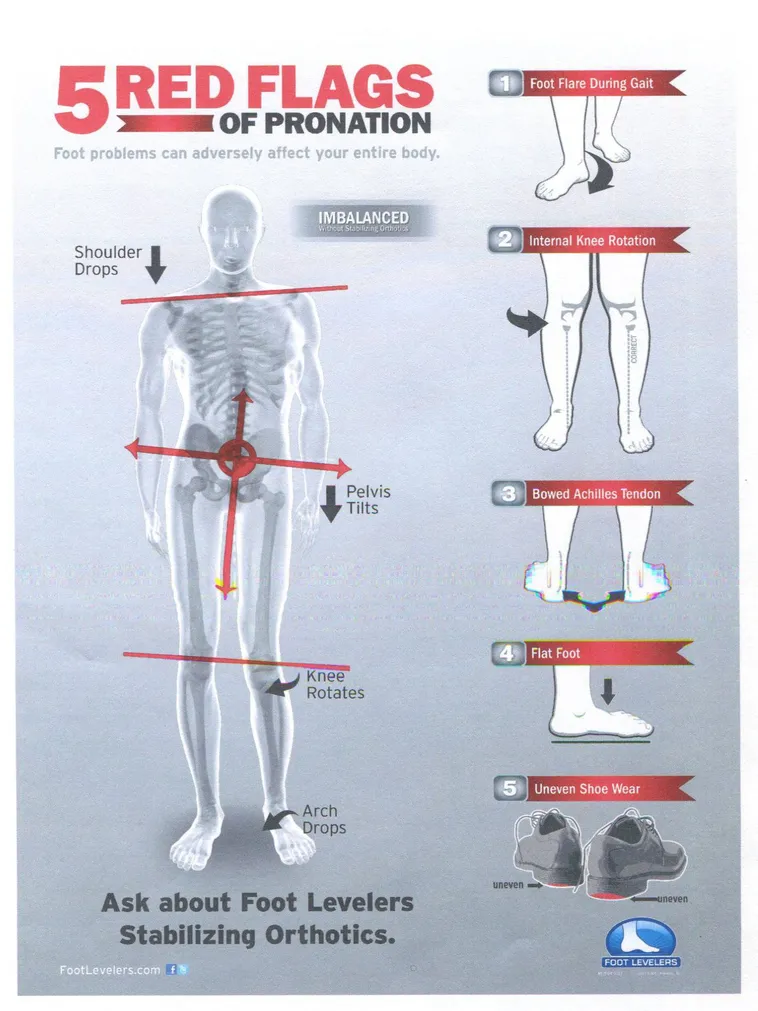 Flat feet and knee pain