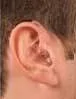 The Behind-the-Ear (BTE) 2