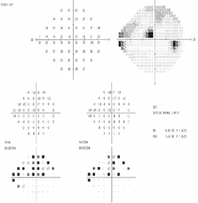 Test results