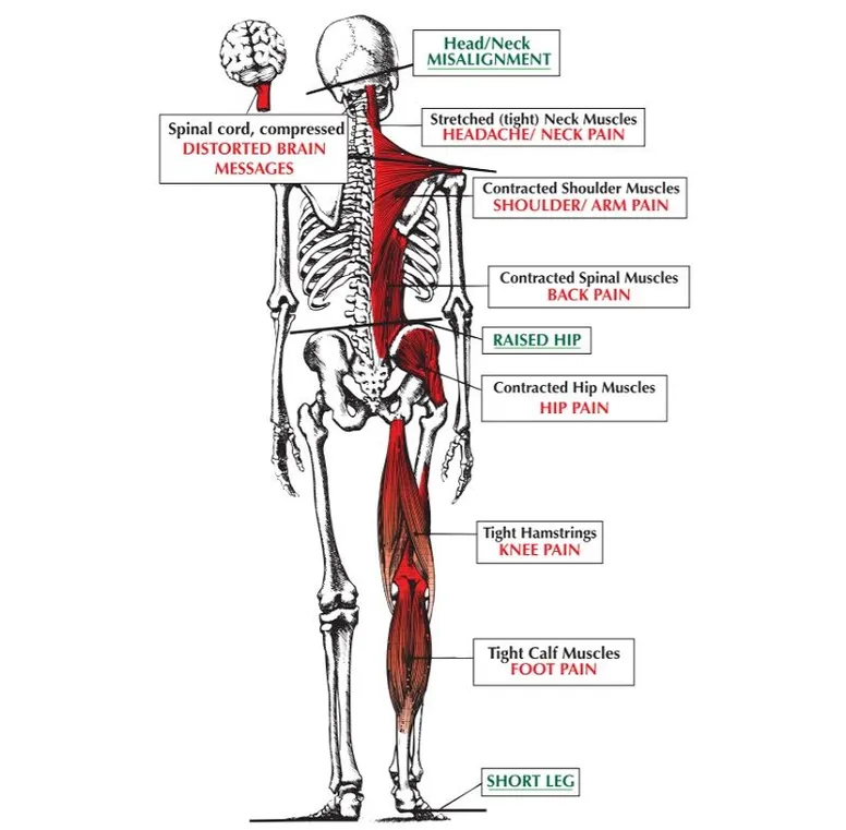 Atlas Orthogonal Symptoms