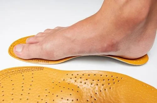 Man with flatfoot wearing custom orthotic shoe inserts
