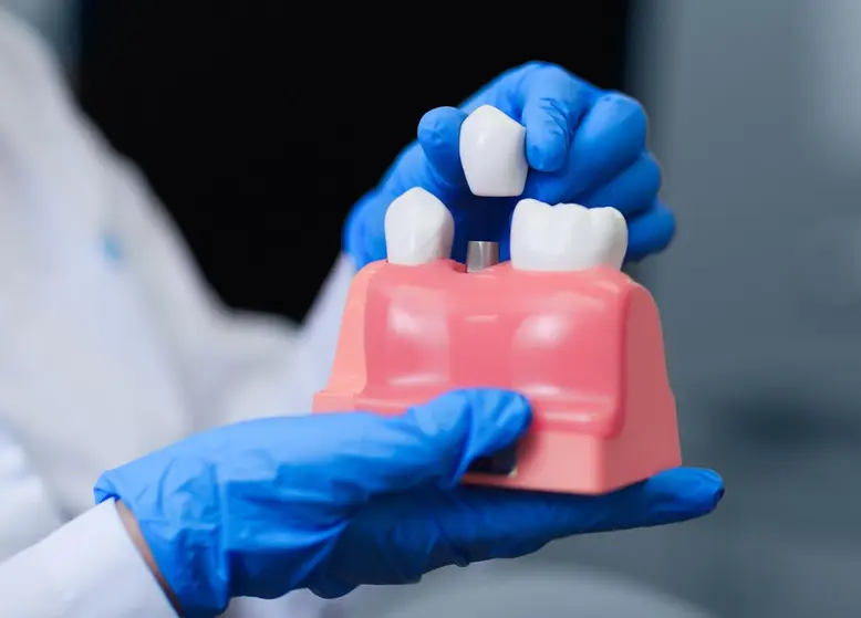 Dental Implant - Chevy Chase, MD Dentist | Anett John, DDS