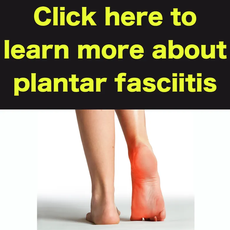 plantar fasciitis