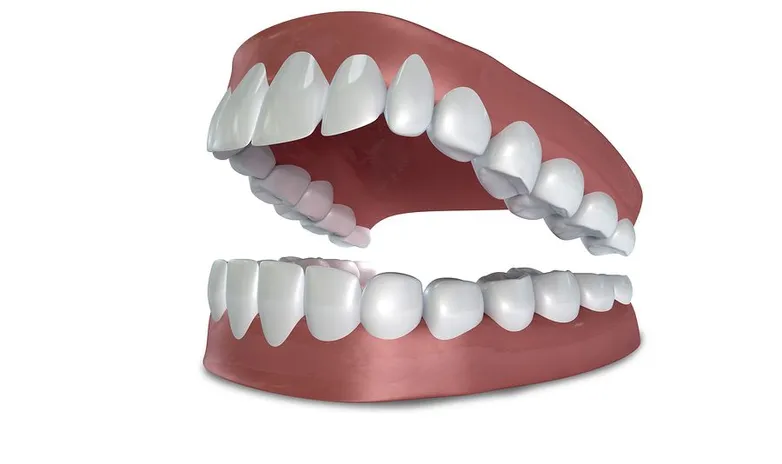 Dentures Naples FL