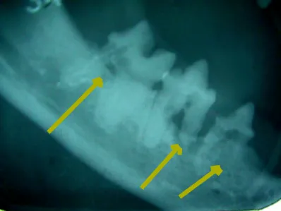 Dental_cavity_radiograph_1_1.jpg