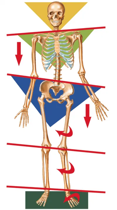 ImbalancedSkeleton_1.jpg