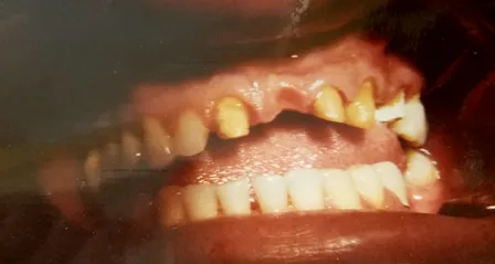 Cosmetic Dentistry Before, San Marcos