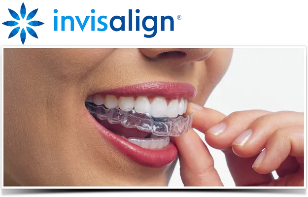 Fort Myers Invisalign