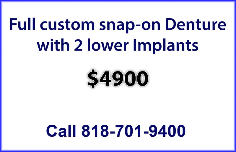 Implant Dentures