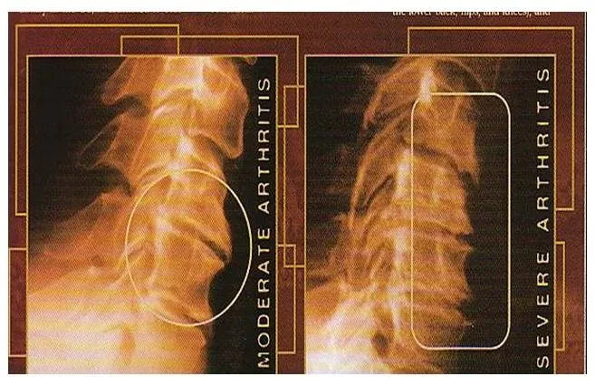 x_ray_joint2.jpg