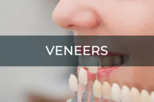 Veneers