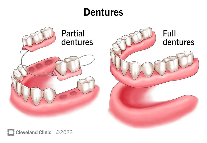 dentures