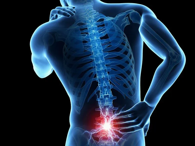 low back pain img.