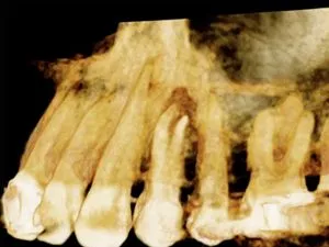 Cone Beam CT Benefits