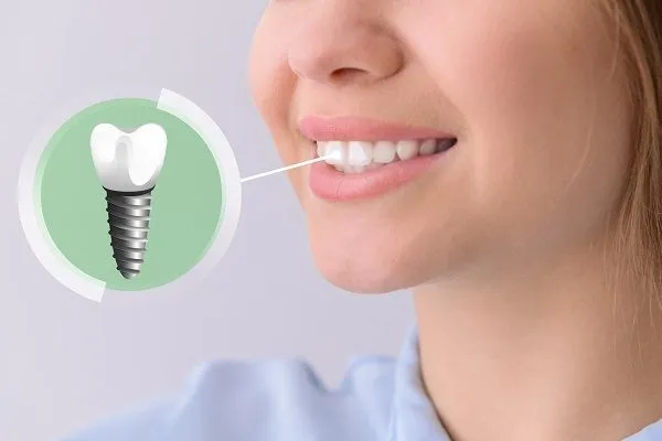 Anatomy | Dental implants Clinton / Shelby/ Washington Township MI