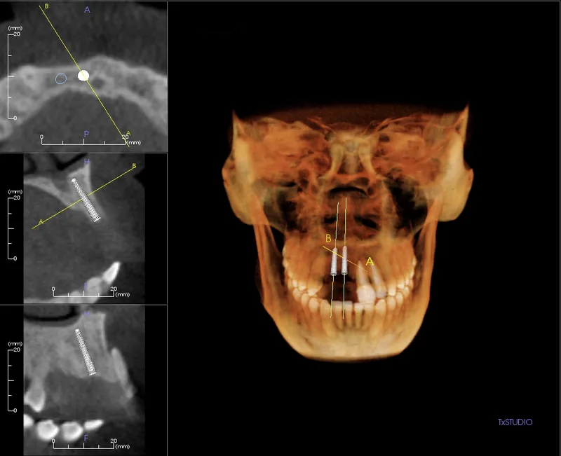 CT-SCAN