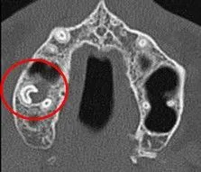 Cone Beam CT Uses